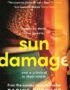 Sun Damage