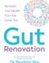 Gut Renovation